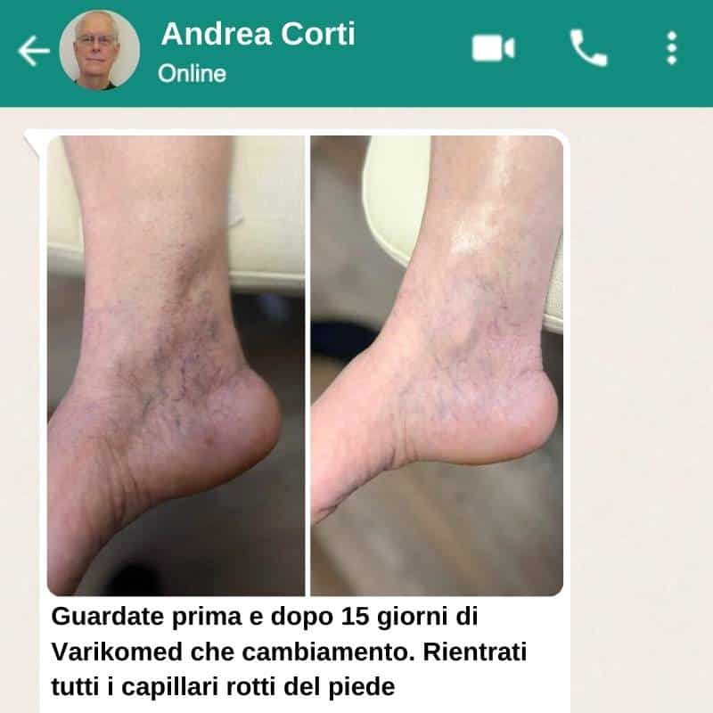 varikomed_WAPP 3